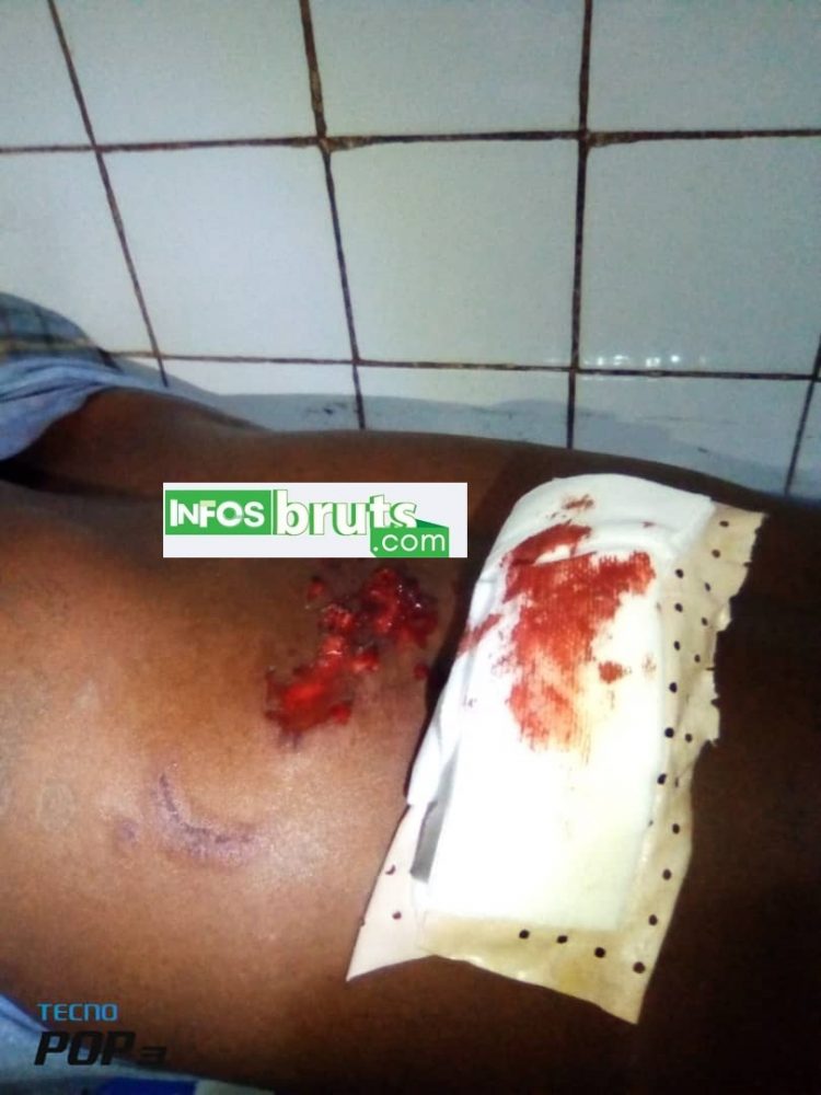 Kankan : Un enseignant blessé par balles par des bandits à Dalabani, sur la nationale Kankan-Conakry
