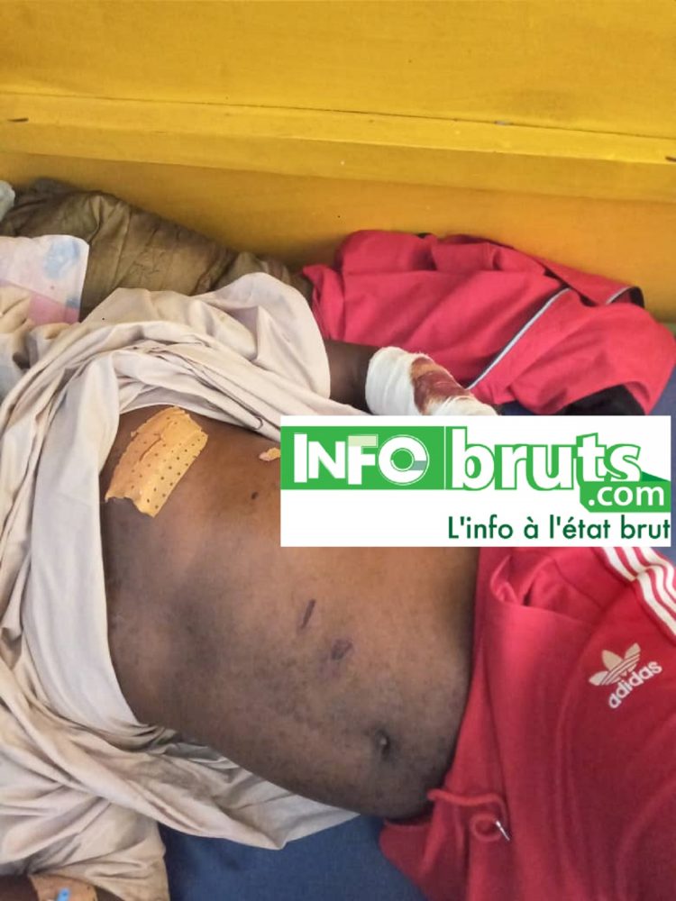 Koïn (Tougué) : l’inconnu qui a ouvert le feu sur le principal du collège toujours introuvable